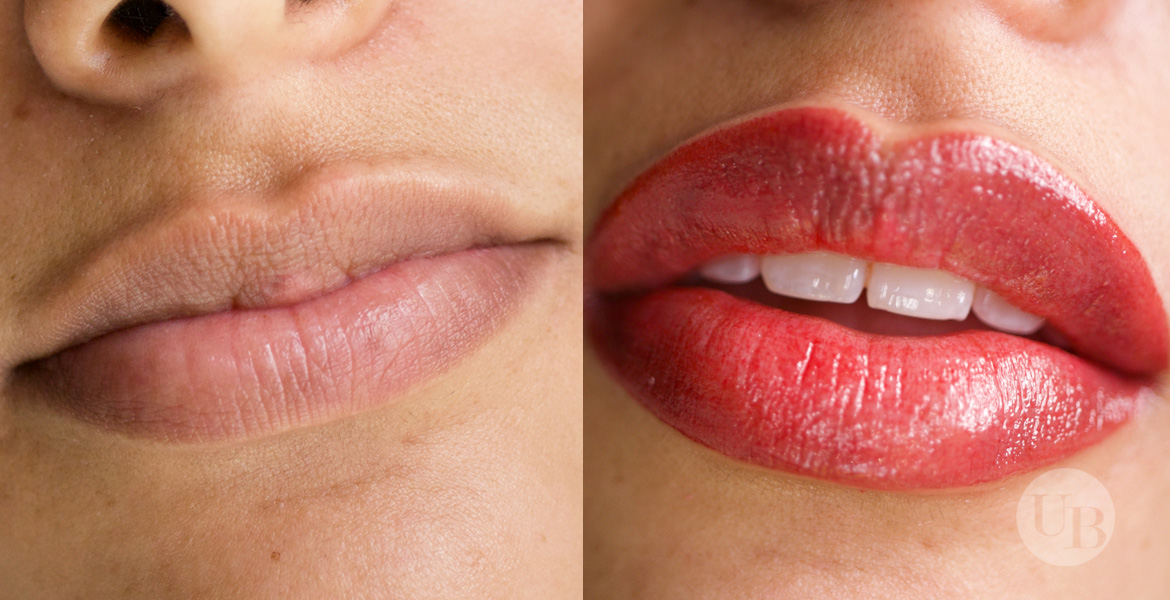 lip pigmentation