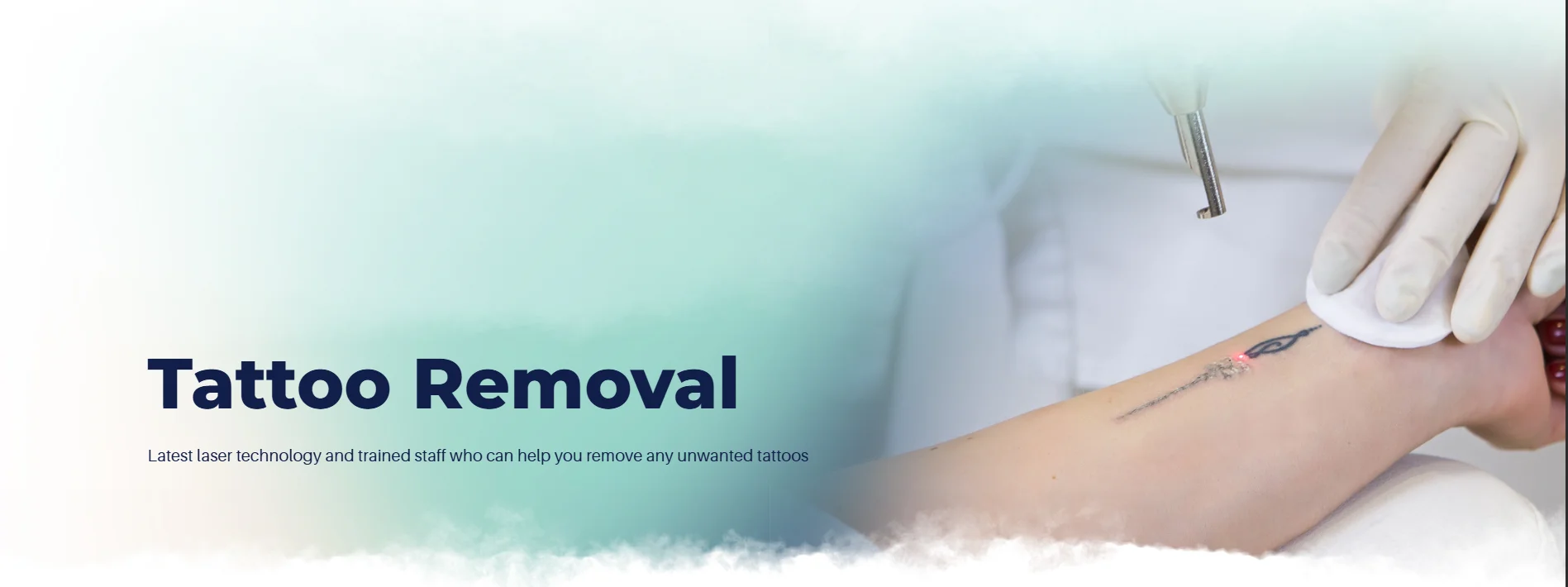 Tattoo Removal